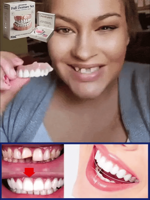 Flexible denture set for upper and lower jaw – reusable & customisable