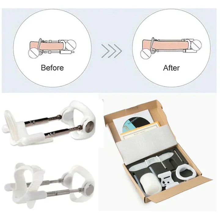 Male Enlargement Extender - Traction Device