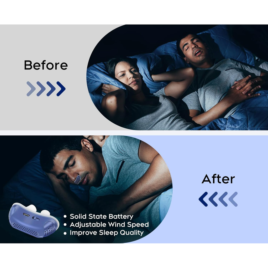 Anti Snoring Device Sleep Apnea Electric Nasal Dilator Rechargeable with Micro Fans